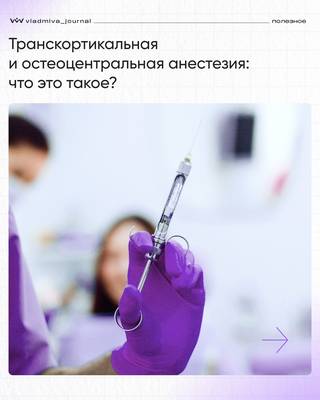 Инфильтрационная анестезия: быстрое обезболивание без онемения губ.